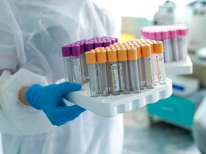 В России за сутки 23 652 новых случая коронавирусной инфекции, скончались 454 человека