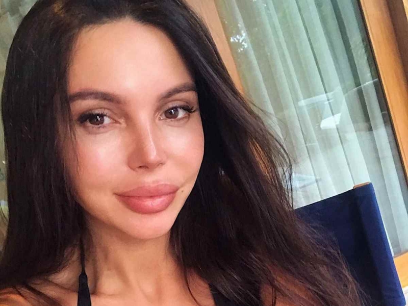 Опухшая Самойлова: «У меня вообще никаких губ не будет»