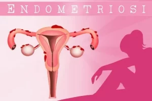 Эндометриоз реже встречается у полных женщин