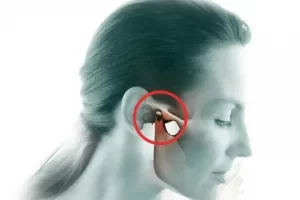 Дисфункция ВНЧС: клиника БИЭМ