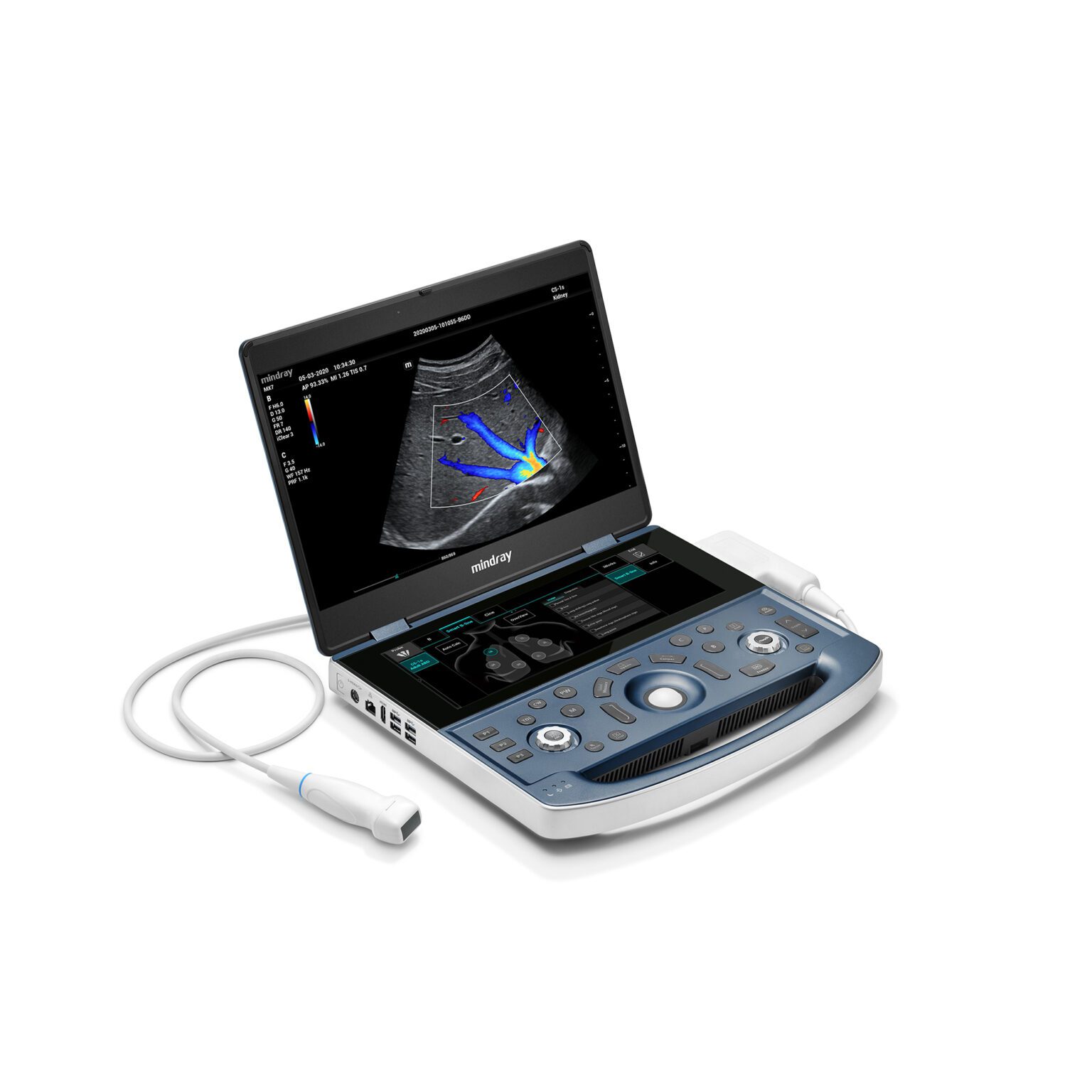 Портативные аппараты УЗИ: преимущества, назначение